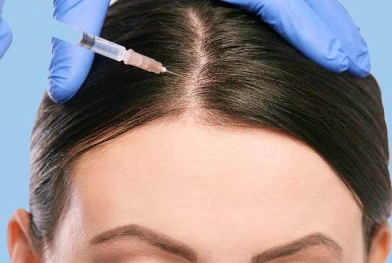 دکتر مزوتراپی مو - رشت